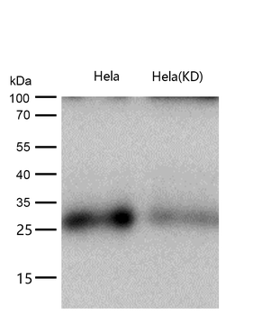 Bcl10 Rabbit mAb [KD Validated] Antibody