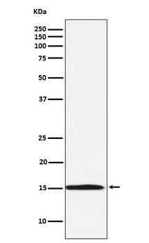 Ube2N / Ubc13 Rabbit mAb Antibody