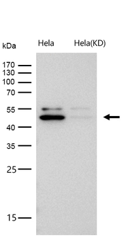 Arp3 Rabbit mAb [KD Validated] Antibody