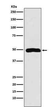 Arp3 Rabbit mAb [KD Validated] Antibody
