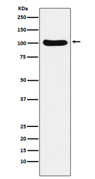 Exportin2 Rabbit mAb [KD Validated] Antibody