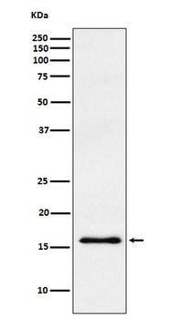 gamma Synuclein Rabbit mAb Antibody