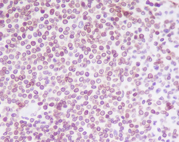 Lamin B2 Rabbit mAb [KD Validated] Antibody