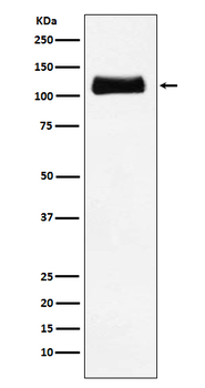 ApoER2 Rabbit Monoclonal Antibody