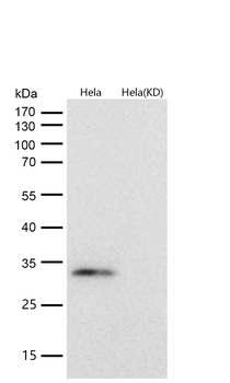 GC1q R Rabbit mAb [KD Validated] Antibody