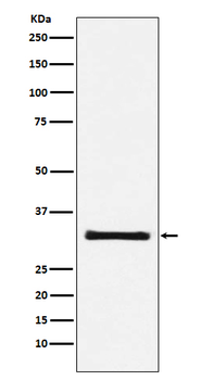 GC1q R Rabbit mAb [KD Validated] Antibody