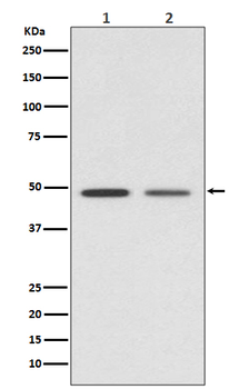Vitamin D Receptor Rabbit mAb Antibody
