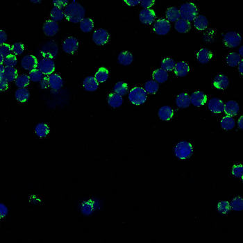 CD147 Rabbit mAb [KD Validated] Antibody