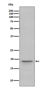 Myelin Basic Protein Rabbit mAb Antibody