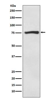ACSS2 Rabbit Monoclonal Antibody