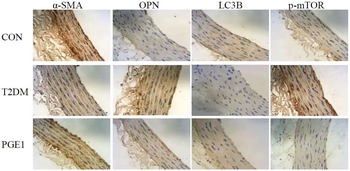 LC3B Rabbit mAb Antibody