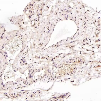 LC3B Rabbit mAb Antibody