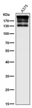 ARID1A Rabbit mAb [KD Validated] Antibody