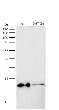 HSPB8/HSP22 Rabbit Monoclonal Antibody