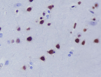 HDAC9 Rabbit mAb [KD Validated] Antibody