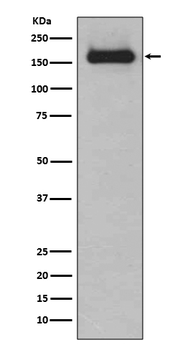 HDAC9 Rabbit mAb [KD Validated] Antibody