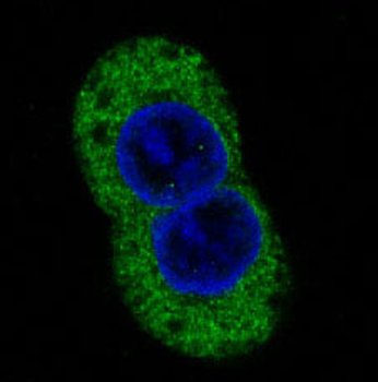 STAT2 Rabbit mAb Antibody