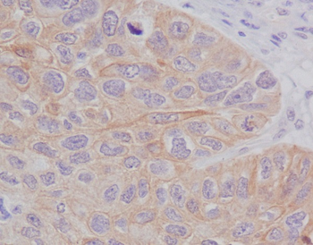 STAT2 Rabbit mAb Antibody