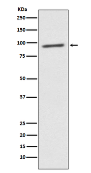 STAT2 Rabbit mAb Antibody
