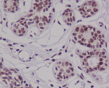 Cyclin E2 Rabbit Monoclonal Antibody