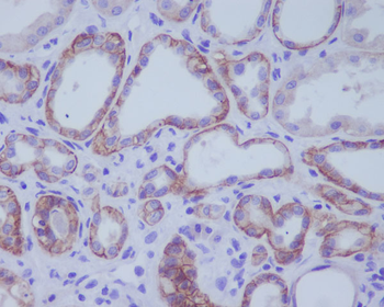 ACE2 Rabbit mAb Antibody