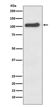 ACE2 Rabbit mAb Antibody