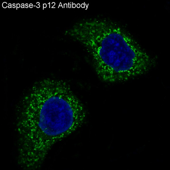 Caspase-3 p12 Rabbit mAb [KD Validated] Antibody