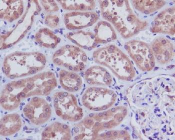Caspase-3 p12 Rabbit mAb [KD Validated] Antibody