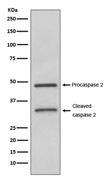 Caspase-2 Rabbit mAb [KD Validated] Antibody
