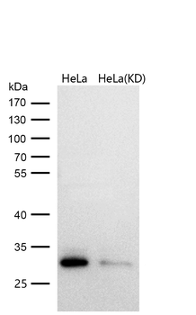 Bcl10 Rabbit mAb [KD Validated] Antibody