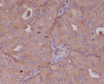 Bcl10 Rabbit mAb [KD Validated] Antibody