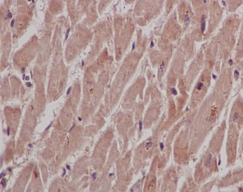 SHP2 Rabbit mAb [KD Validated] Antibody