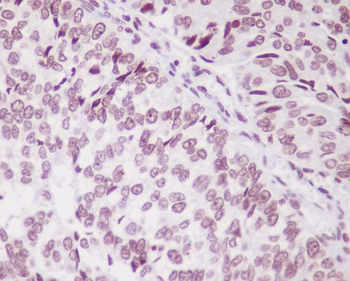 PARK7 Rabbit mAb [KD Validated] Antibody