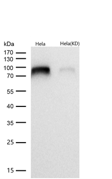 IKK alpha Rabbit mAb [KD Validated] Antibody