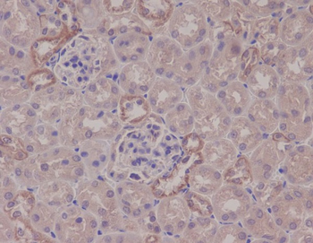 IKK alpha Rabbit mAb [KD Validated] Antibody