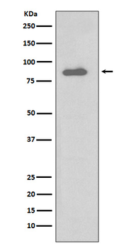 IKK alpha Rabbit mAb [KD Validated] Antibody