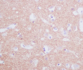 Tyrosine Hydroxylase Rabbit Monoclonal Antibody