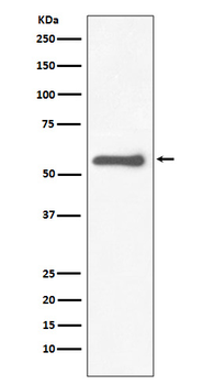 Tyrosine Hydroxylase Rabbit Monoclonal Antibody