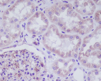 ADIPOR1 Rabbit mAb [KD Validated] Antibody