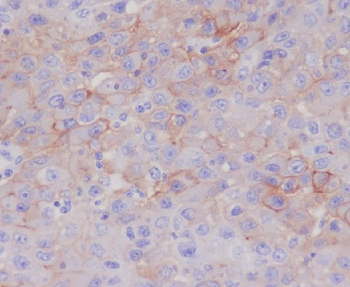 P Glycoprotein Rabbit Monoclonal Antibody