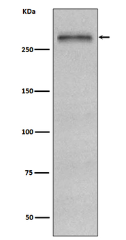 Fibronectin Rabbit mAb [KD Validated] Antibody