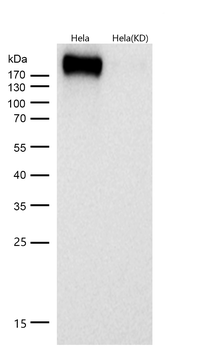 Tuberin Rabbit mAb [KD Validated] Antibody