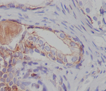 Tuberin Rabbit mAb [KD Validated] Antibody