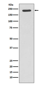 Tuberin Rabbit mAb [KD Validated] Antibody