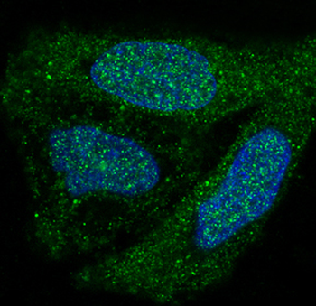 p38 MAPK Rabbit mAb [KD Validated] Antibody