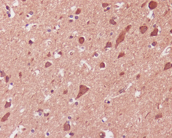 p38 MAPK Rabbit mAb [KD Validated] Antibody