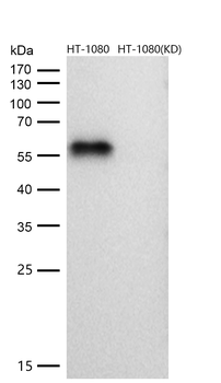 Smad2 Rabbit mAb [KD Validated] Antibody