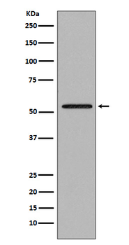 Smad2 Rabbit mAb [KD Validated] Antibody