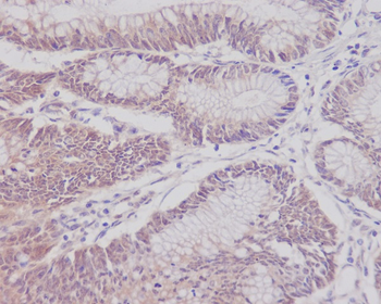CD3 epsilon Rabbit mAb Antibody