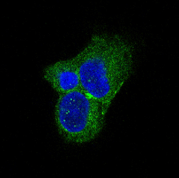 Tyrosine Hydroxylase Rabbit Monoclonal Antibody